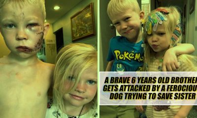 Brave 6 Years Old Brother Gets Attacked by a Ferocious Dog Trying to Save Sister